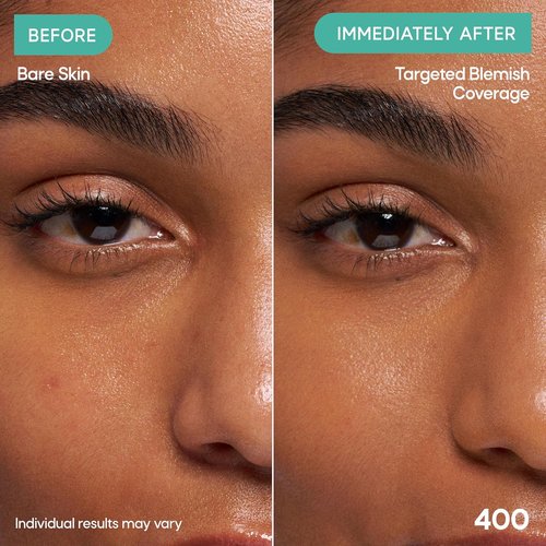 Almay Clear Complexion Concealer - Cruelty-Free, Non-Comedogenic Makeup for Acne-Prone Skin | 0.3 fl oz