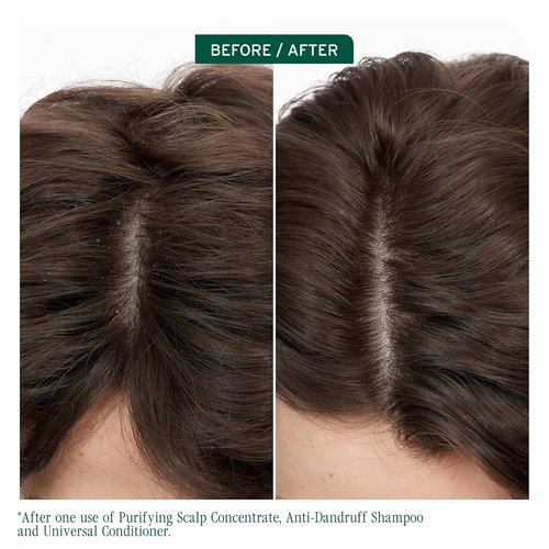 Biolage Scalp Sync Anti-Dandruff Shampoo - Soothes Itchy Scalp & Deeply Cleanses Hair | Vegan & Cruelty-Free, 1.7 FL Oz