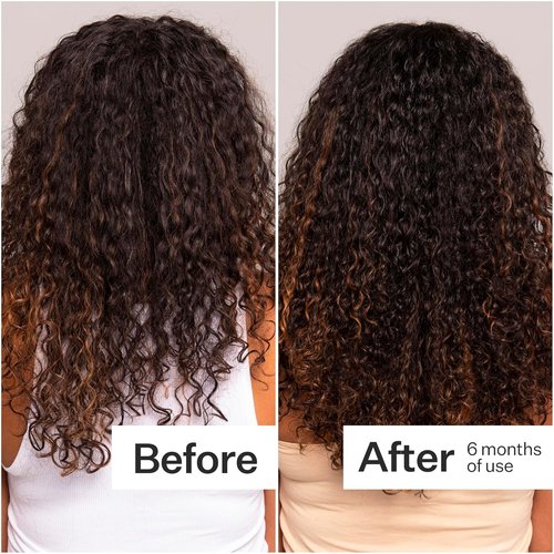 Act+ Acre Cold Processed Stem Cell Scalp Serum - Promotes Thicker Hair & Soothes Scalp - 1 fl oz