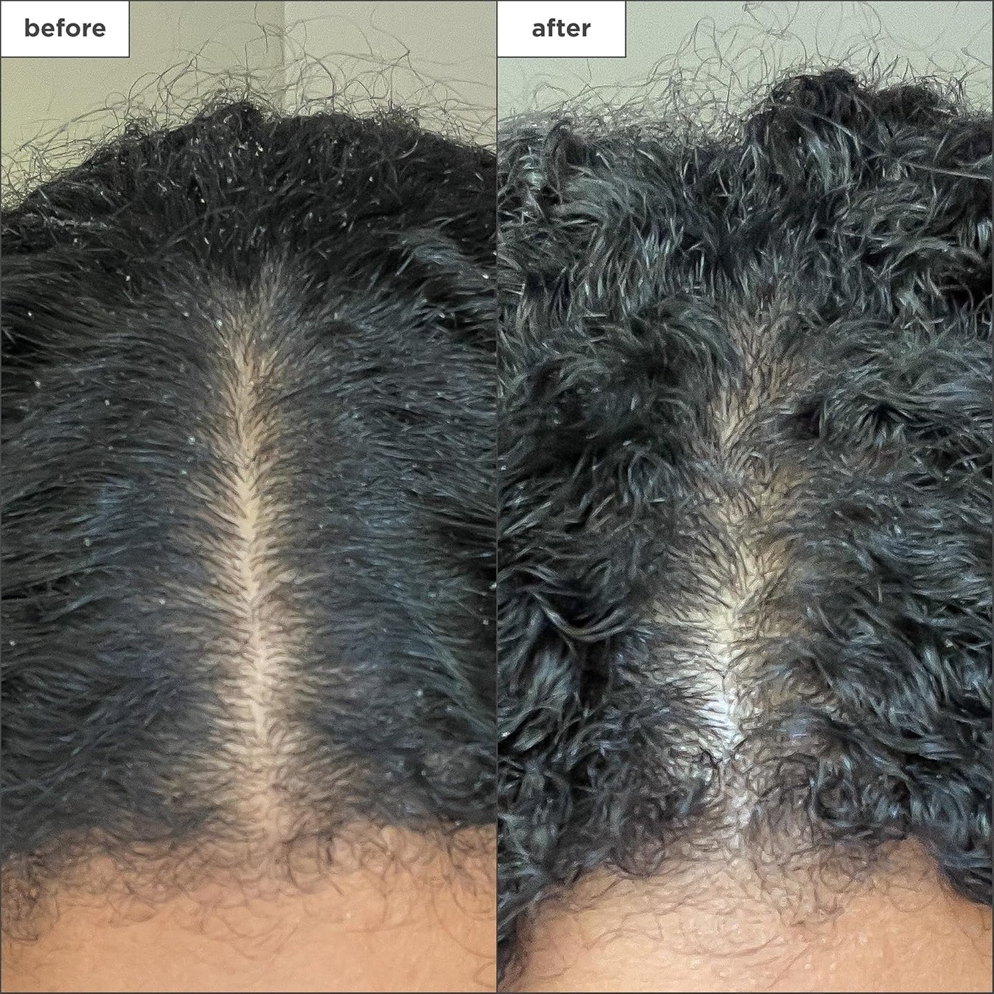 Briogeo Scalp Revival Detox Bundle - Charcoal & Coconut Oil Shampoo + Scalp Massager | Soothes Itchy Scalp | 8 fl oz