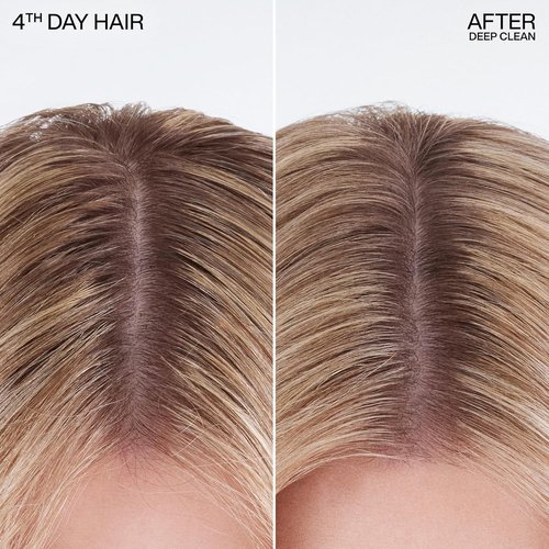 Redken Deep Clean Dry Shampoo - Instantly Refreshes All Hair Types | No Buildup, Dark or Light Hair