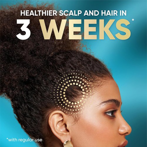 Head & Shoulders Royal Oils Scalp Cream Treatment - Daily Moisture with Coconut Oil, 5.0 fl oz