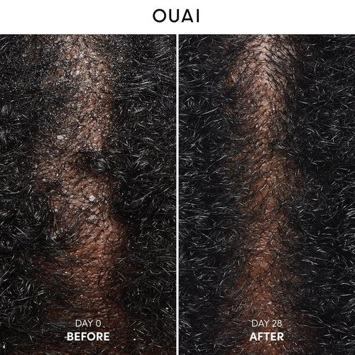 OUAI Anti Dandruff Shampoo - Soothing Salicylic Acid Formula for Flaky, Itchy Scalp - 10 Fl Oz