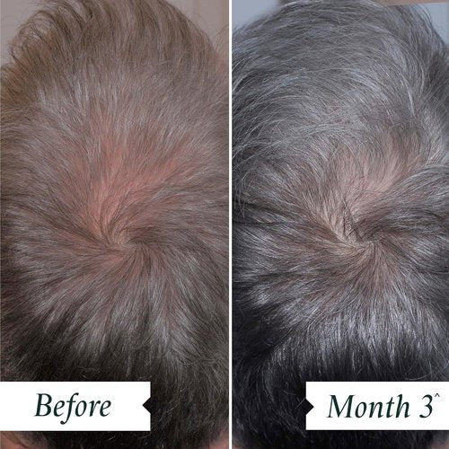 Philip Kingsley Density Preserving Serum - Thinning Hair & Scalp Care for Thickness, 2.87 oz