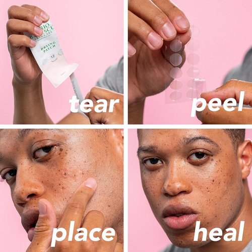 Mario Badescu Drying Patch - Invisible Blemish Treatment with Vitamin C | 60 Patches (12mm)