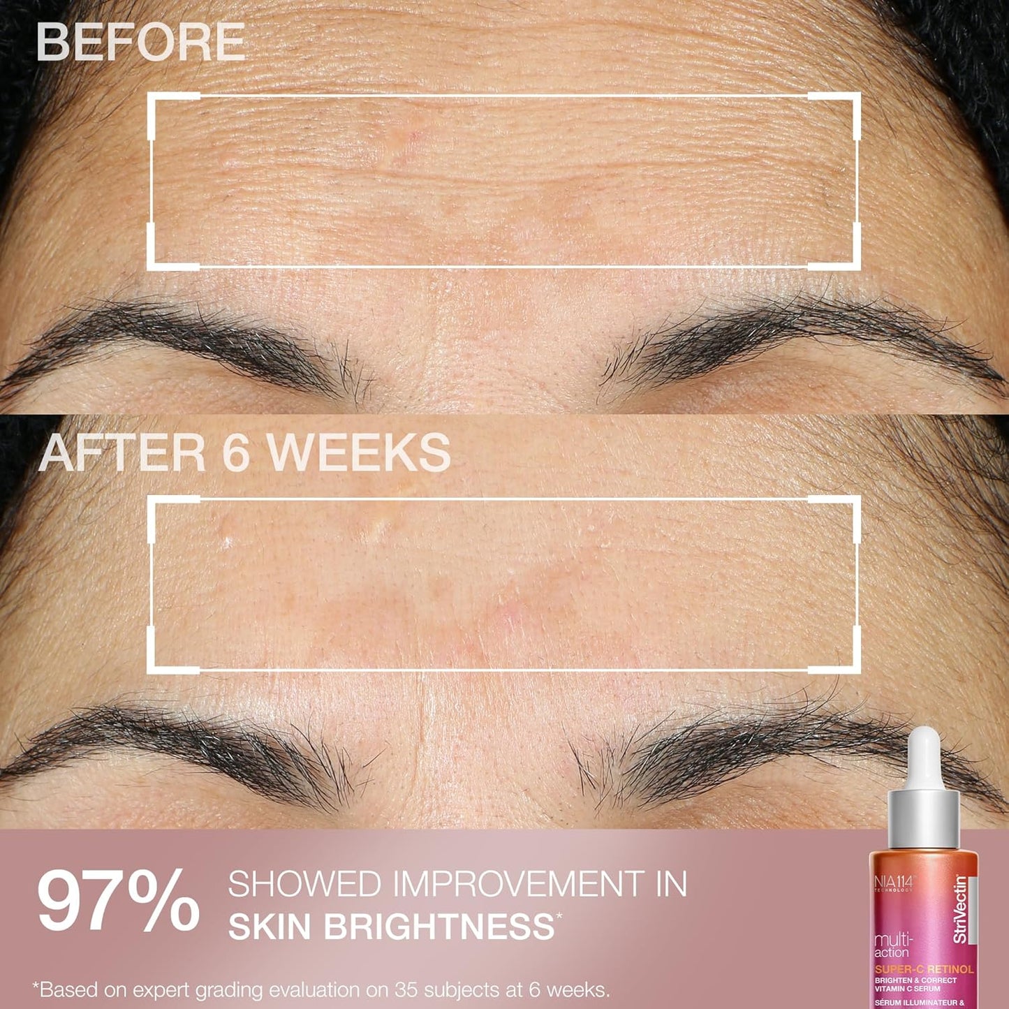 StriVectin Skin Care Holiday Gift Kits - Brightening, Smoothing & Hydrating Beauty Sets