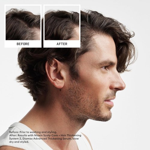 Nioxin System 2 Hair Thickening Leave-In Treatment - Boost Density & Strengthen Natural Hair with Niacinamide & Biotin