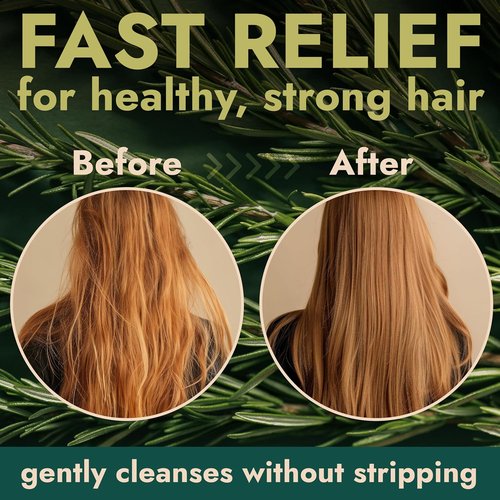 Rosemary Shampoo and Conditioner Set - Tea Tree & Rosemary Oils for Scalp Relief | Sulfate-Free, Boosts Shine + Free Scalp Brush | 16.9 fl oz