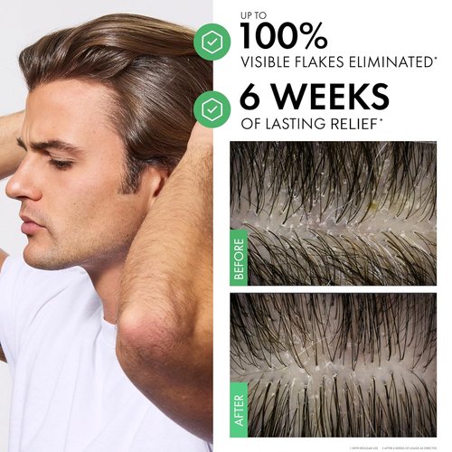 Dercos Dandruff Shampoo - Antifungal Treatment for Dry Scalp Relief | Prescription Strength Selenium Sulfide