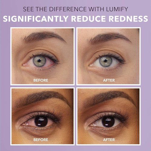 LUMIFY Eye Drops - Fast Redness Relief for Brighter Eyes | Works in 1 Minute, Lasts 8 Hours, 0.25 Fl Oz