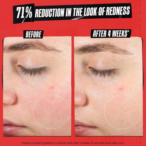 Kiehl's Ultra Facial Recovery Barrier Cream - Lightweight Moisturizing Lotion for Dry, Sensitive Skin