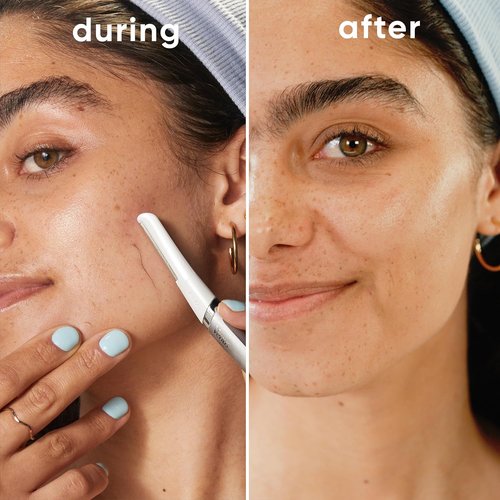 Gillette Venus Facial Razor Refills - Exfoliating Dermaplaning Blades, 4-Count for Smooth Skin