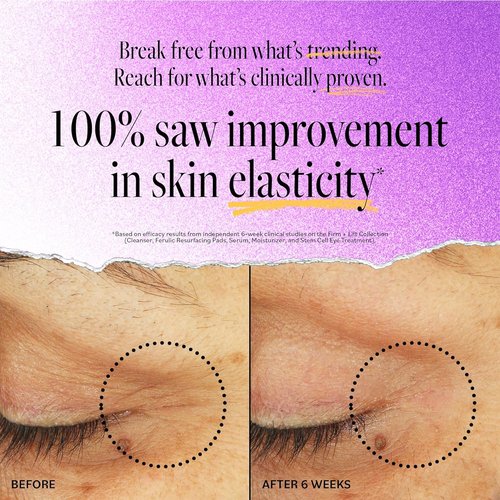 Derma E Stem Cell Lifting Eye Treatment - Firming & Tightening Cream for Under Eyes | 0.5oz Hydrating Moisturizer