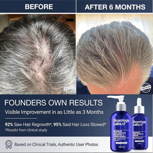 Guyology Labs Biotin Hair Growth Serum - DHT Blocker & Anti-Thinning Treatment for All Hair Types - Made in USA