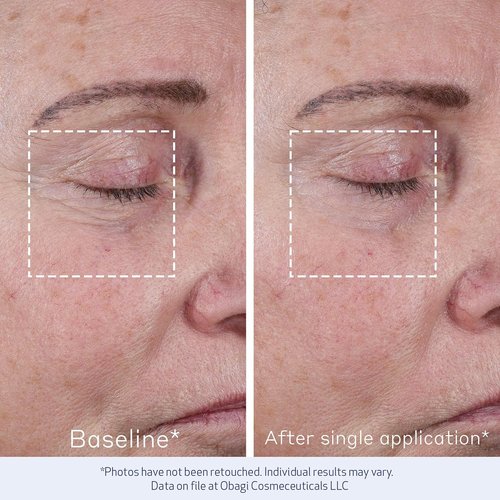 Obagi ELASTIderm Advanced Filler Concentrate - Non-Injectable Filler with Biomimetic Peptide Technology for Firm Skin & Reduced Fine Lines