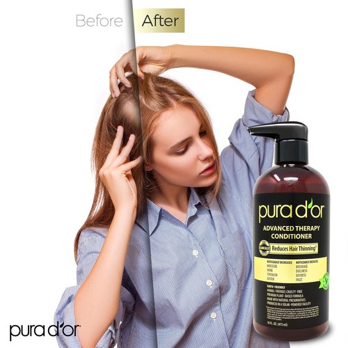 PURA D'OR Advanced Therapy Conditioner - Moisturizing, Strengthening & Volumizing | 16oz, Sulfate-Free, Argan Oil & Biotin, Suitable for All Hair Types