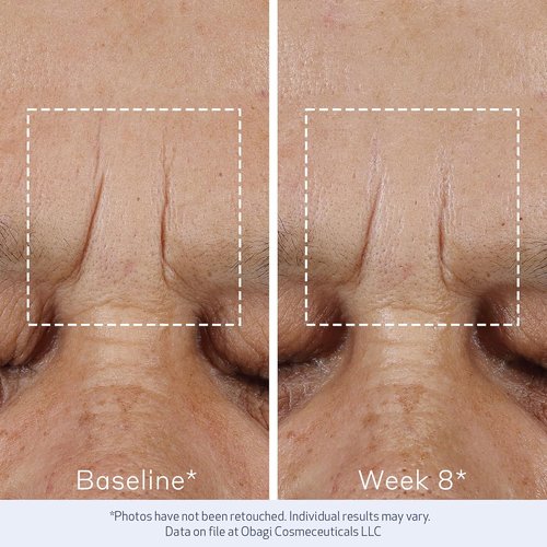 Obagi ELASTIderm Advanced Filler Concentrate - Non-Injectable Filler with Biomimetic Peptide Technology for Firm Skin & Reduced Fine Lines