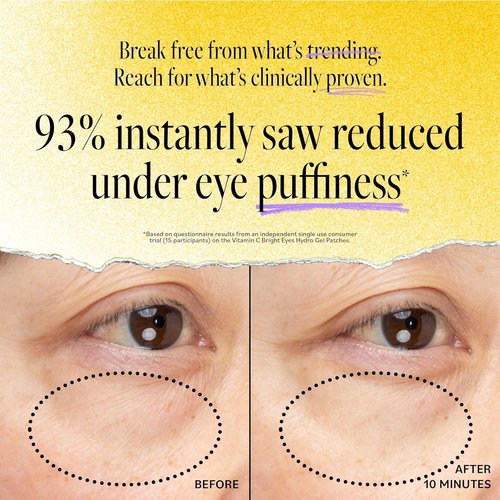 Derma E Vitamin C Bright Eyes Hydro Gel Under Eye Patches - Reduce Dark Circles & Puffiness (10 Ct)