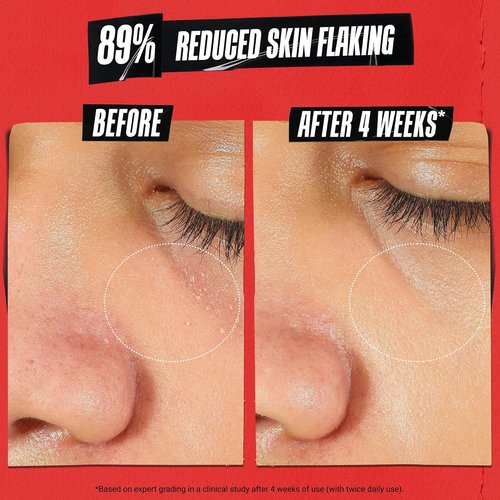 Kiehl's Ultra Facial Recovery Barrier Cream - Lightweight Moisturizing Lotion for Dry, Sensitive Skin