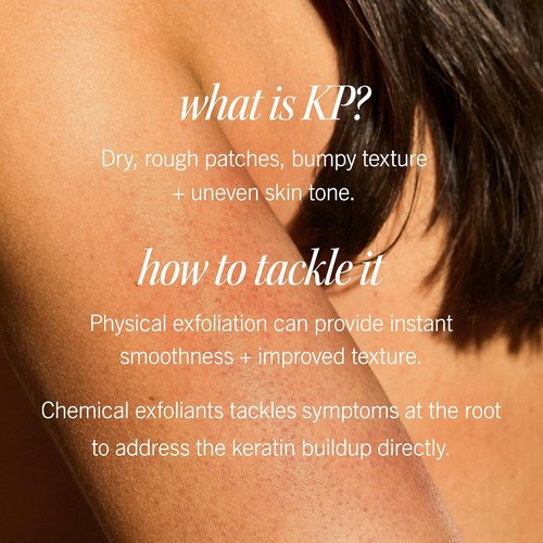 First Aid Beauty - KP Bump Eraser Body Scrub | 10% AHA Exfoliator for Keratosis Pilaris, 8 oz