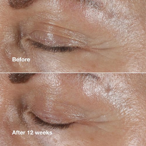 Clinique Smart Clinical Repair Eye Cream - Anti-Aging Hydration with Hyaluronic Acid & Peptides | 0.5 oz
