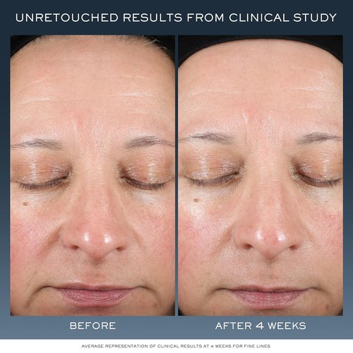 Lancôme Advanced Génifique Night Cream - Overnight Skin Barrier Repair with Bifidus Prebiotic & Hyaluronic Acid - 1.7 Fl Oz