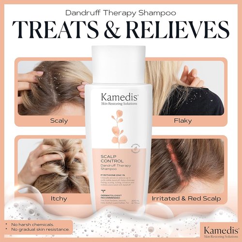 KAMEDIS Anti Dandruff Shampoo - Triple Power Formula with 1% Zinc Pyrithione & Salicylic Acid | 6.7 Fl Oz