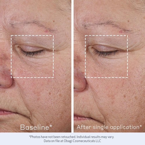Obagi ELASTIderm Advanced Filler Concentrate - Non-Injectable Filler with Biomimetic Peptide Technology for Firm Skin & Reduced Fine Lines