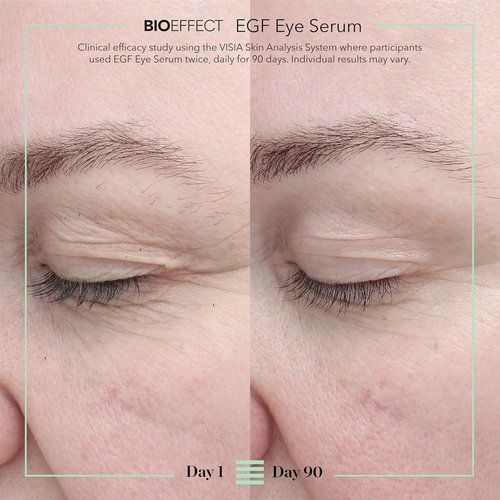 BIOEFFECT EGF Eye Serum - Age-Defying Rollerball Treatment for Fine Lines & Puffiness | 6 mL / 0.20 oz