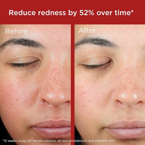 EltaMD UV Skin Recovery Sunscreen SPF 50 - All Mineral Zinc Oxide Formula for Sensitive Skin
