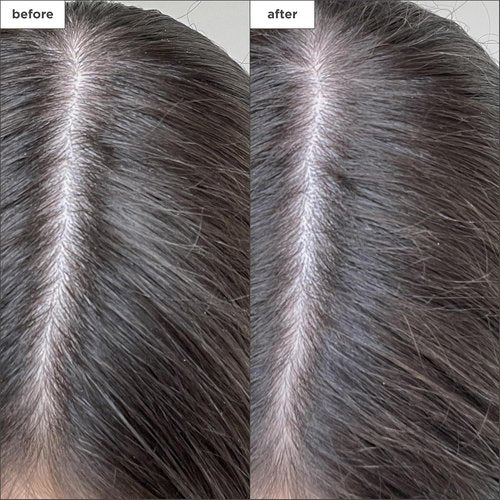 Briogeo Scalp Revival Dry Shampoo - Charcoal & Biotin Powder for Oily Roots | Vegan & Cruelty-Free | 1.7 oz.