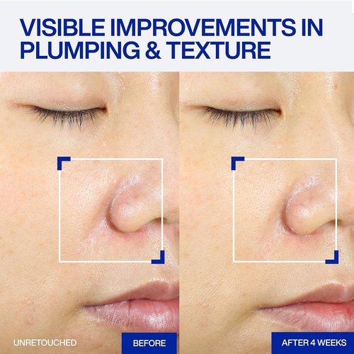 IOPE XMD Stem III Clinical Recovery Serum - Professional PDRN Treatment for Firmness & Volume - 1.69 fl. oz.
