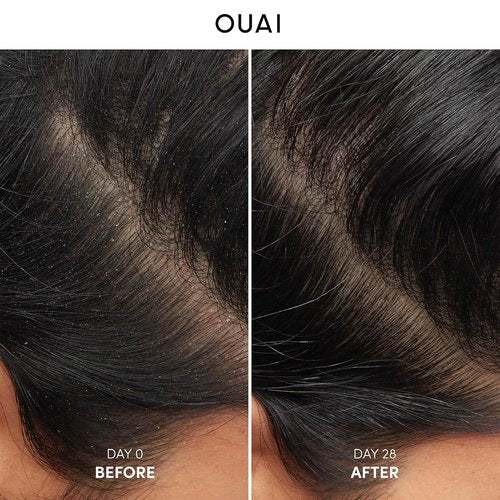 OUAI Anti Dandruff Shampoo - Soothing Salicylic Acid Formula for Flaky, Itchy Scalp - 10 Fl Oz