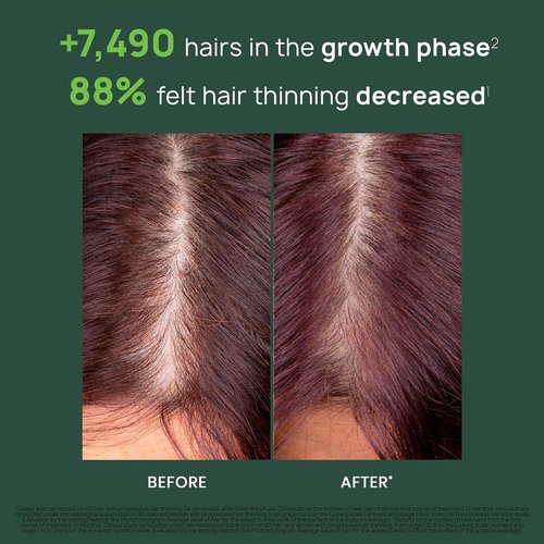 Rene Furterer Triphasic Serum for Hereditary Thinning Hair - Drug-Free Leave-In Treatment | 30-Day Supply