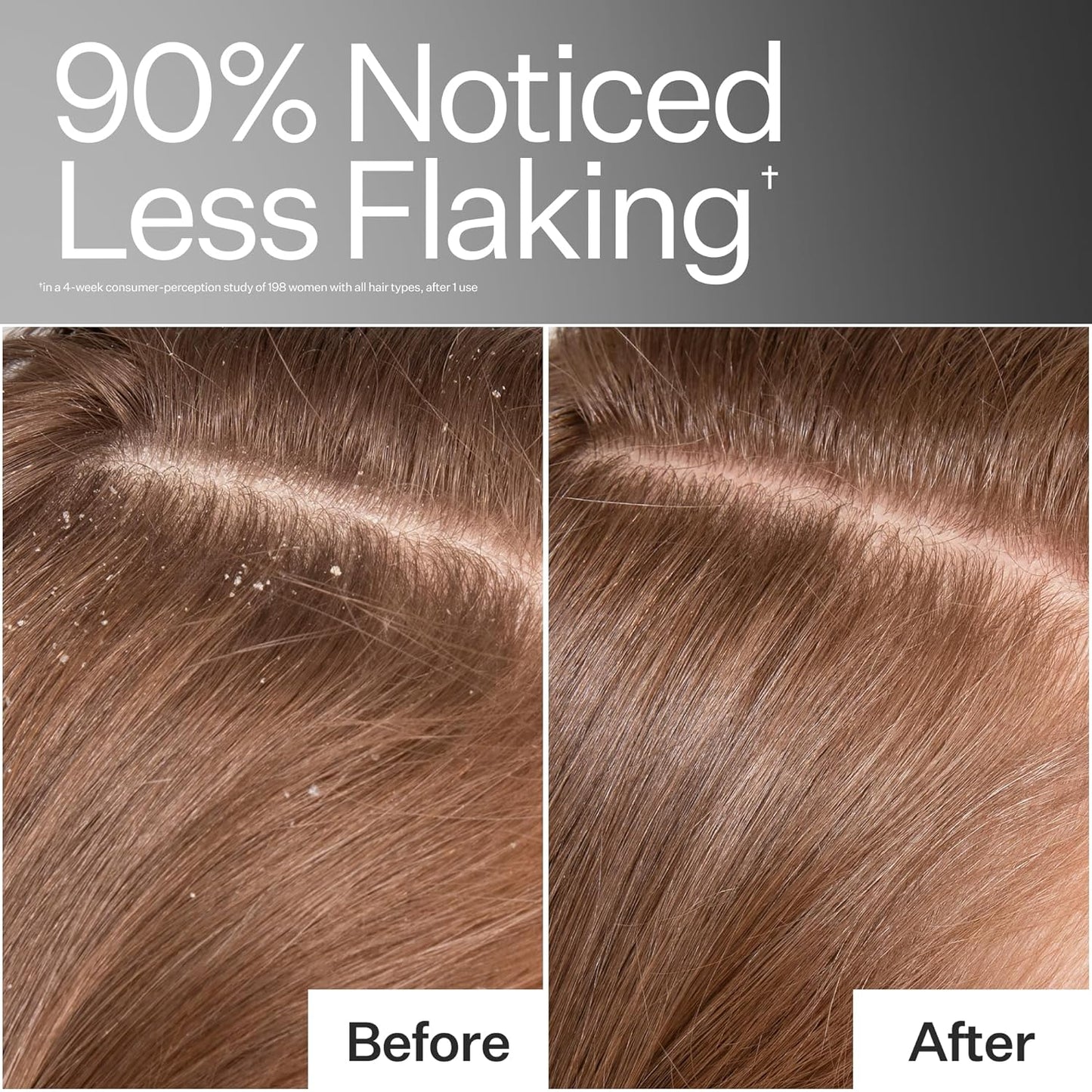 ACT+ ACRE Cold Processed Scalp Detox Oil - Sulfate-Free Treatment for Flaky, Dry Scalp - Promotes Thicker Hair