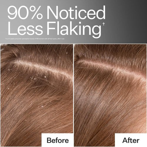 ACT+ ACRE Cold Processed Scalp Detox Oil - Sulfate-Free Care for Flaky, Dry and Itchy Scalp - Promotes Thicker, Fuller-Looking Hair