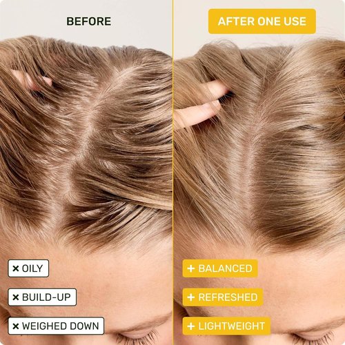 Ethique Clarifying Shampoo Bar - Oily Hair Solution with Castor Oil | Plastic-Free, Vegan, 3.88 oz