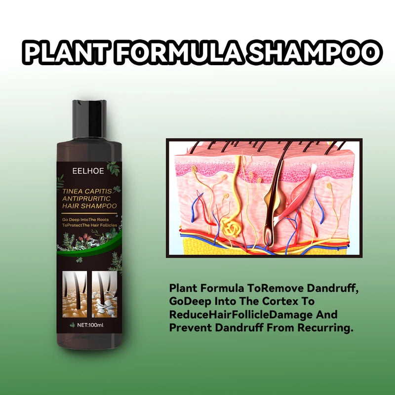 Anti Dandruff Hair Shampoo with Scalp Care & Oil Control - 100ml