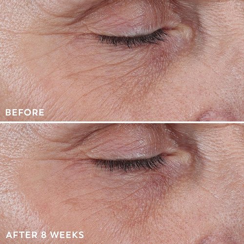 Olay Regenerist Under Eye Cream Roller - Anti-Aging Serum for Wrinkles & Bags, Fragrance-Free, 0.7oz