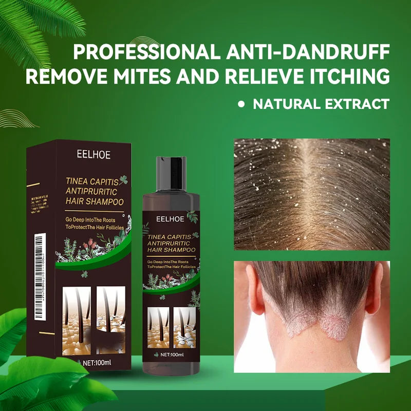 Anti Dandruff Hair Shampoo with Scalp Care & Oil Control - 100ml