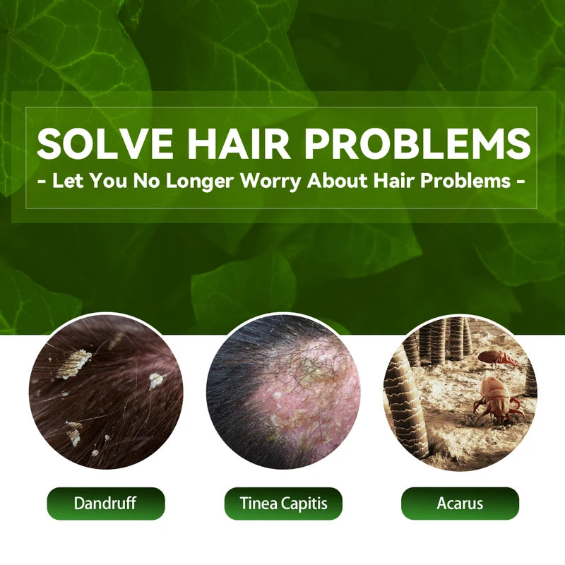 Anti Dandruff Hair Shampoo with Scalp Care & Oil Control - 100ml