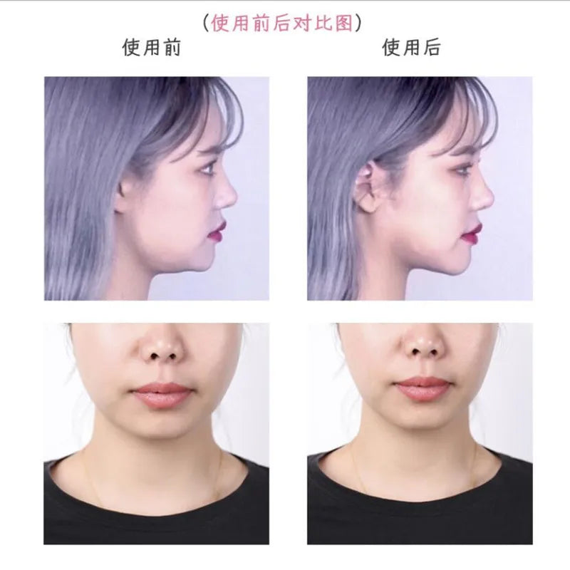Invisible Face Lift Tape 40Pcs for V-Shape Face Slimming Wrinkle Reduction