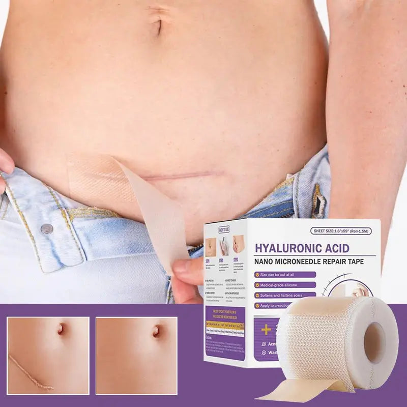 Silicone Scar Removal Patch - Gentle, Breathable Skin Repair Tape for Keloid, Burn & Trauma Scars