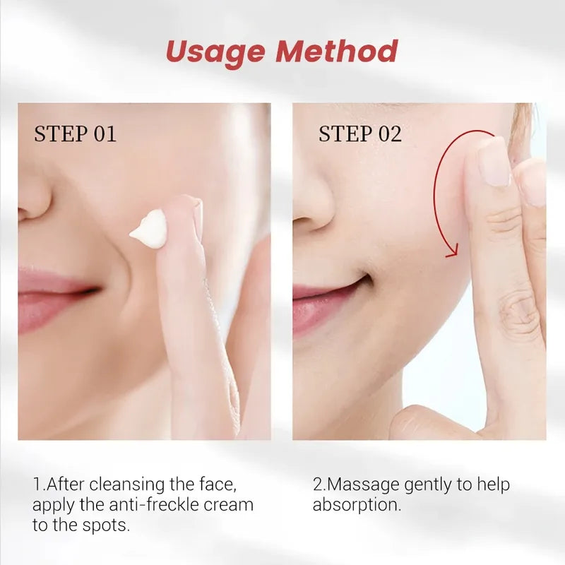 Freckle Cream for Face Brightening & Dark Spot Removal - 20g