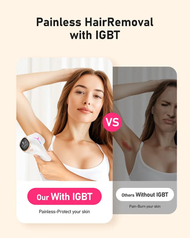 IPL Hair Removal Device with 999999+ Flashes for Face & Body - Painless & Permanent
