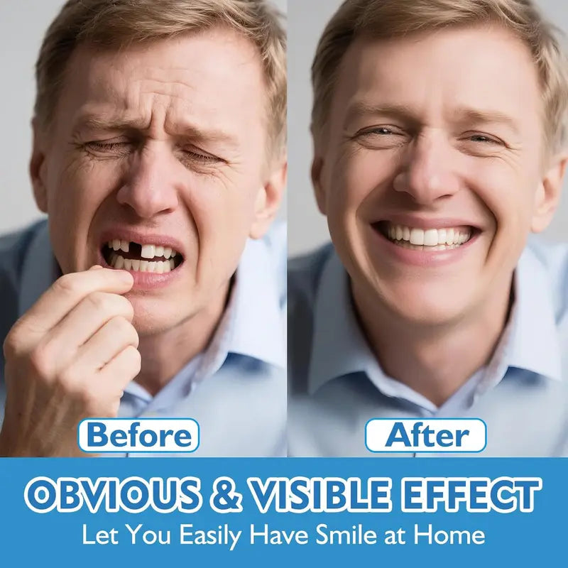Flexible Silicone Dentures Full Set - Realistic Upper & Lower Fake Teeth Kit, Comfort Fit