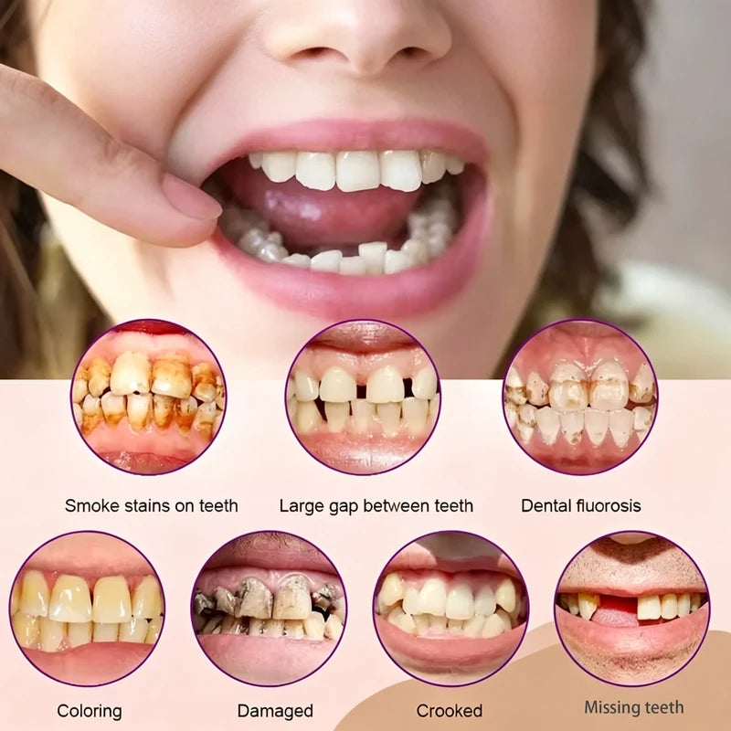 Full Set Silicone Dental Dentures for Men Women - Natural Shade, Daily Oral Hygiene Kit