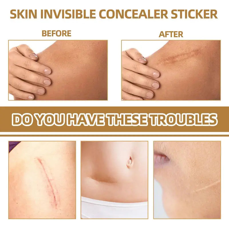 Invisible Scar and Tattoo Cover Stickers Waterproof Silicone Skin Patches 60pcs Set