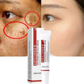 Whitening Freckle Cream for Dark Spot Removal & Brightening - 20g