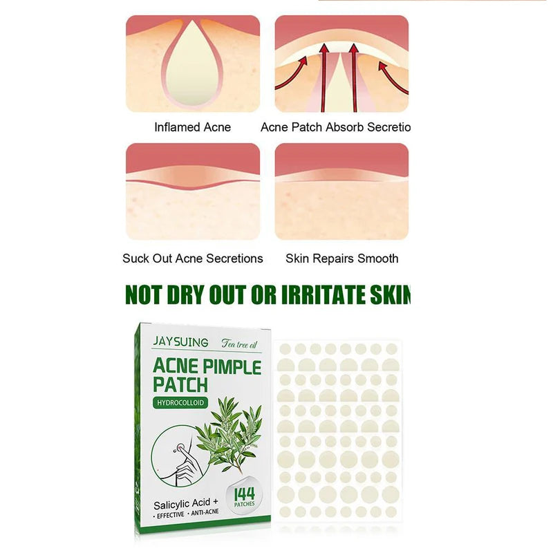 Acne Patches 144pcs Translucent Hydrocolloid Salicylic Tea Tree Oil for Inflamed Skin